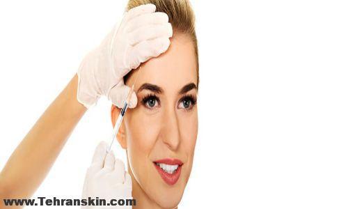 تزریق بوتاکس در اردبیل
