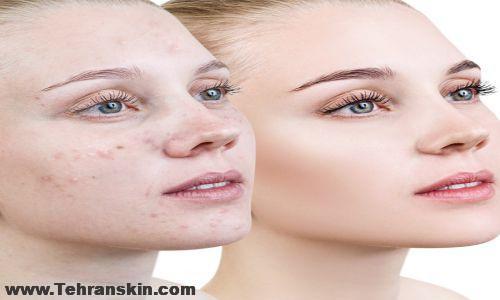 بهترین دکتر پوست در کرمانشاه