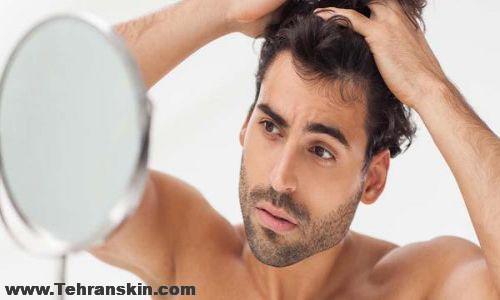 کاشت مو در کرمانشاه