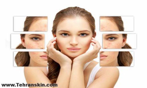 چربی به چه مناطقی از صورت منتقل می شود؟