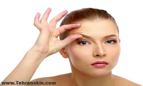 قیمت بوتاکس در کرمانشاه