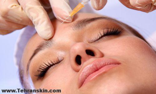 تزریق ژل در کرمانشاه