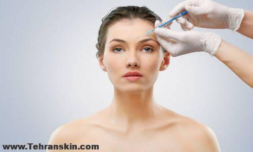 قیمت بوتاکس در همدان