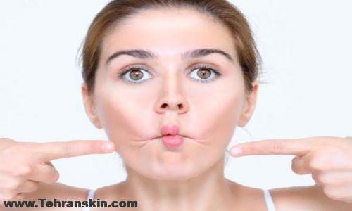 هزینه تزریق چربی در کرمانشاه