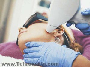لیزر موهای زائد صورت | هزینه ی لیزر موهای زائد صورت 732x549 Laser Hair Removal vs. Electrolysis Which Is Better 300x225 - لیزر موهای زائد صورت | هزینه ی لیزر موهای زائد صورت