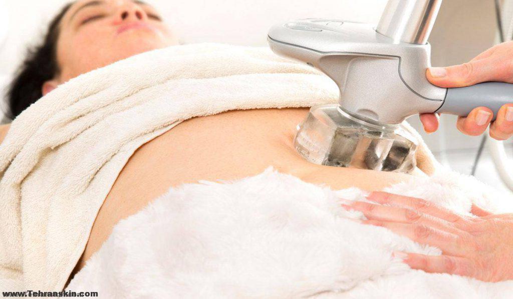 شد الجسم أو رفع الجسم يحسن شكل ونبرة الأنسجة الأساسية التي تدعم الجلد والدهون