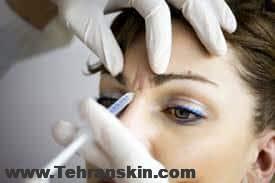 معرفی بهترین کلینیک تزریق بوتاکس | انتخاب بهترین دکتر در اراک