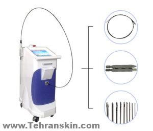 تشمل الاختلافات المتاحة في ليبو الليزر (بناءً على أجهزة محددة