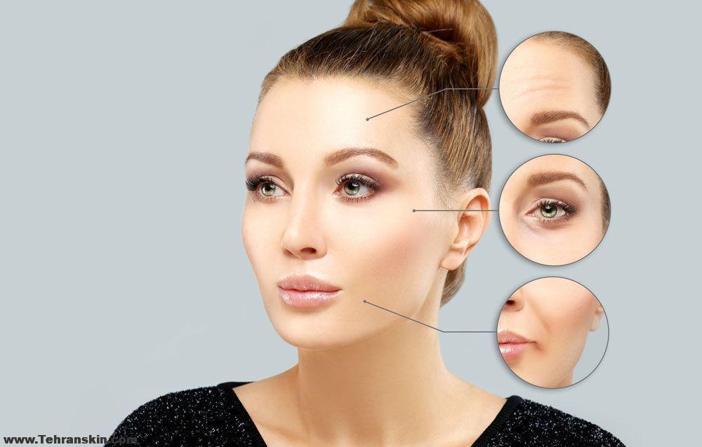 تساعد مواد الحشو الجلدي على تقليل خطوط الوجه واستعادة الحجم والامتلاء في الوجه.