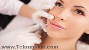 بالنسبة للعديد من الأشخاص ، يمكن أن يكون استخدام مواد الحشو "الجاهزة" إجراءً بسيطًا قائمًا على المكاتب يمكن أن يعزز مظهرهم بشكل رائع.