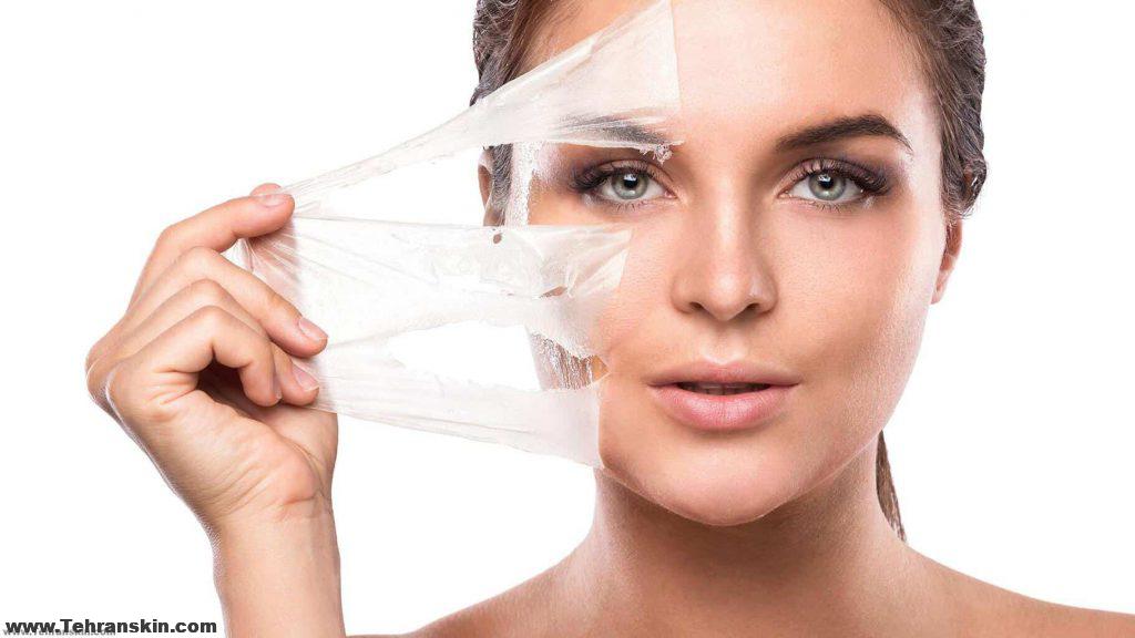 تستخدم علاجات التقشير السطحي الدقيقة أداة كاشطة خفيفة لرمل جلدك بلطف ،