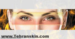 بهترین فوق تخصص جراحی پلک در تهران | هزینه جراحی بلفاروپلاستی Plasma jet of Nose and eyelids at Berke Clinic 300x156 - بهترین فوق تخصص جراحی پلک در تهران | هزینه جراحی بلفاروپلاستی