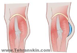 ما هي عملية تكبير الأرداف ؟