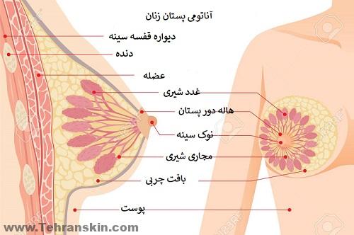 jتزریق ژل به سینه