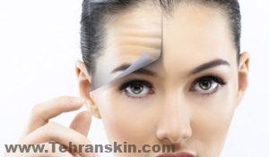 إذا كنت تزعجك علامات الشيخوخة هذه في منطقة الحاجب ، فقد يكون رفع الحاجب مناسبًا لك.