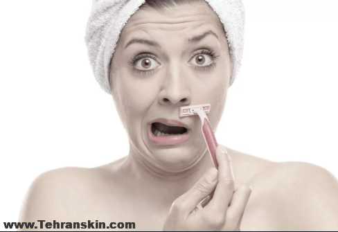 از بین بردن موهای زائد صورت با لیزر