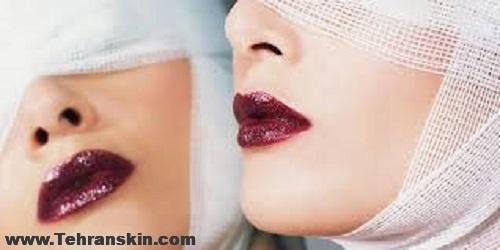 نظرات مردم درباره پیکرتراشی و تزریق چربی