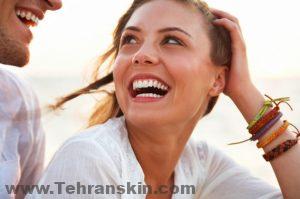 خط خنده را چگونه از بین ببریم؟| درمان قطعی خط خنده girl laughing beach 300x199 - خط خنده را چگونه از بین ببریم؟| درمان قطعی خط خنده