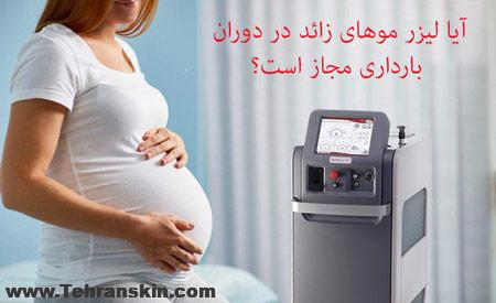لیزر مو های زائد در دوران بارداری