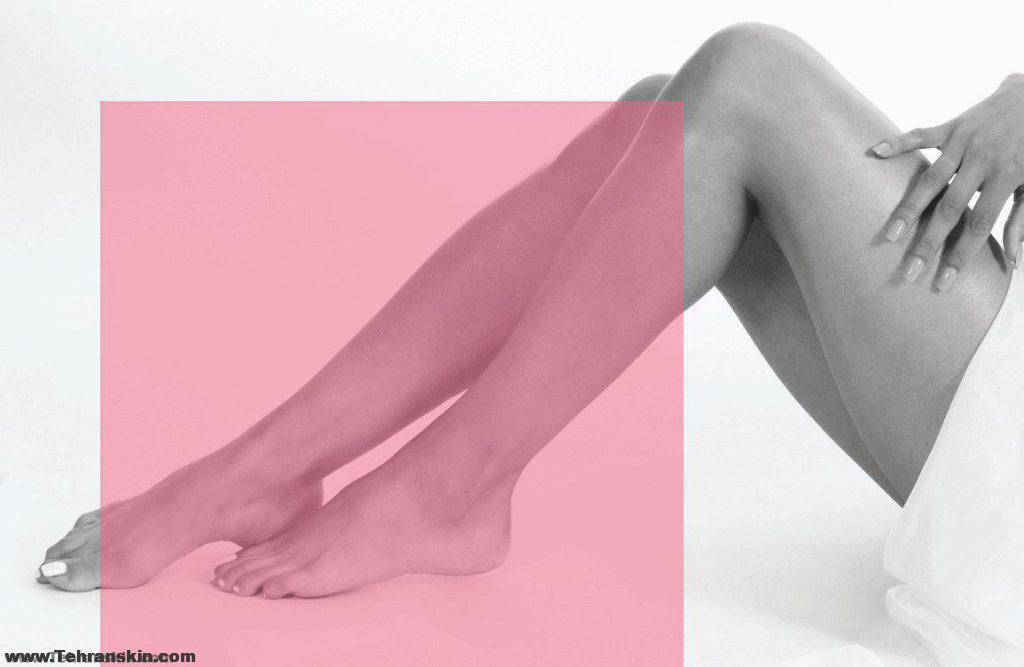 جوابدهی لیزر موهای زائد