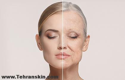 جوانسازی صورت با پی آر پی