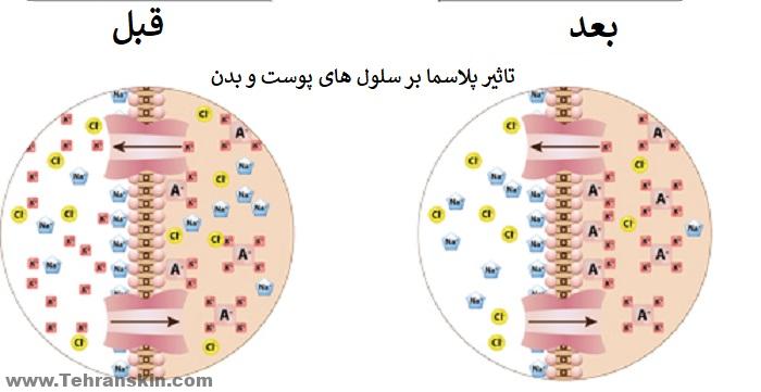 پلاسما جت چگونه عمل می کند؟ 