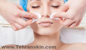 ما هي خطوات عملية التقشير السطحي ؟