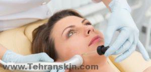 يمكن إجراء تسحيج الجلد وتقشيرالبشرة  بسرعة إلى حد ما