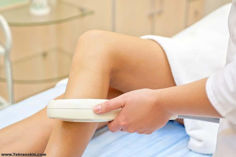 لیزر مو های زائد در دوران بارداری