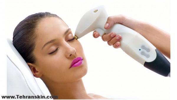 تفاوت لیزر و IPL