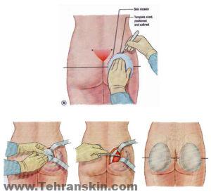 إجراءات لعملية تكبير الأرداف