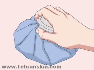 استفاده از کمپرس سرد پس از لیزر