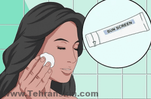 اجتناب از نور آفتاب بعد از لیزر