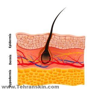ساختار پوست