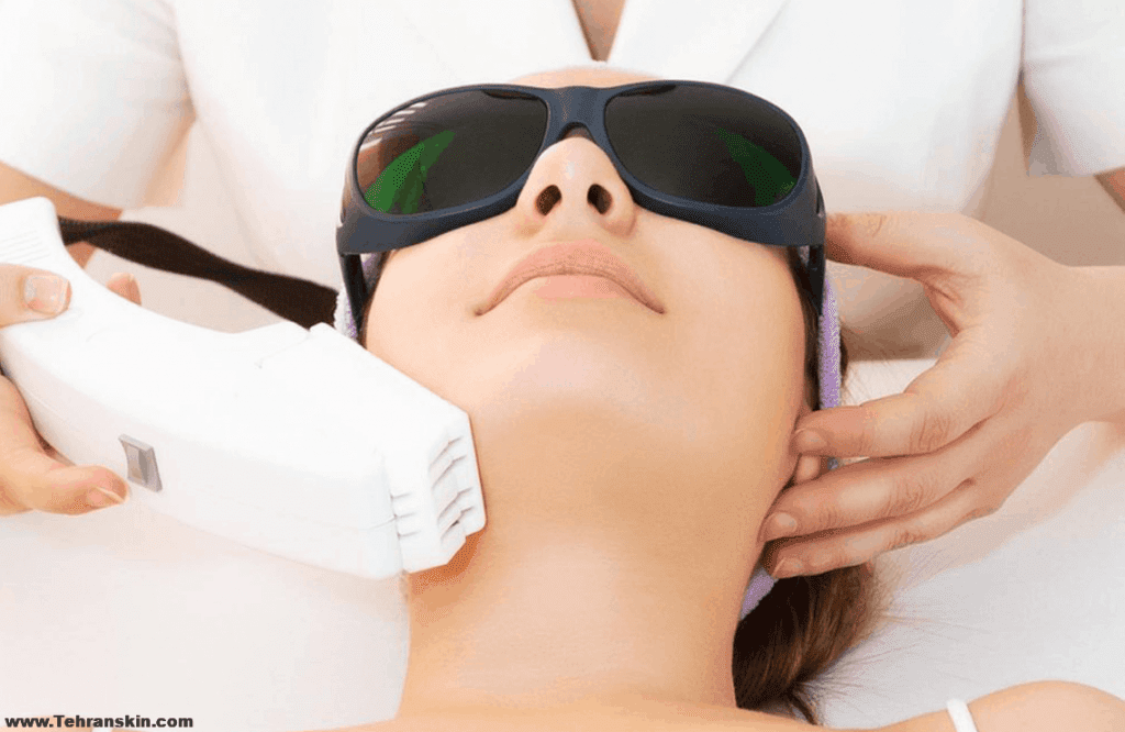 كيف تعمل إزالة الشعر بالليزر