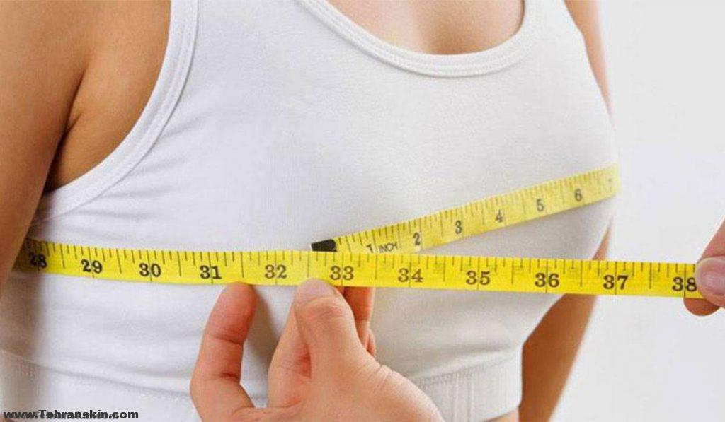 جراحة رفع الثدي ، المعروف أيضًا باسم تثبيت الثدي، يرفع الثديين عن طريق إزالة الجلد الزائد