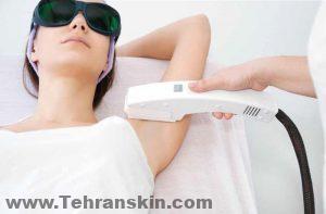 إن نظرية العلاج بالليزر لفقدان الشعر هي أن العلاج بالليزر منخفض الجرعة ينشط الدورة الدموية والتحفيز الذي يشجع بصيلات الشعر على نمو الشعر.