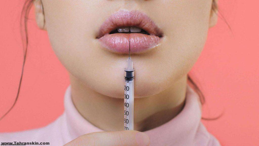 کمپرس یخ بعد از تزریق ژل