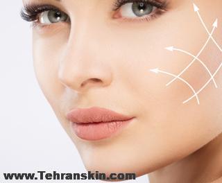 گونه گذاری در اهواز