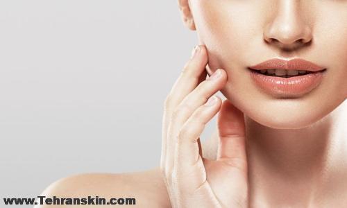 ورم بعد از تزریق ژل لب