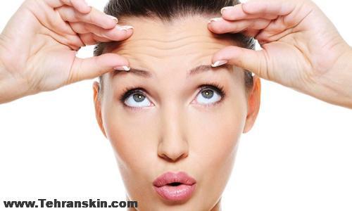 بوتاکس در شیراز