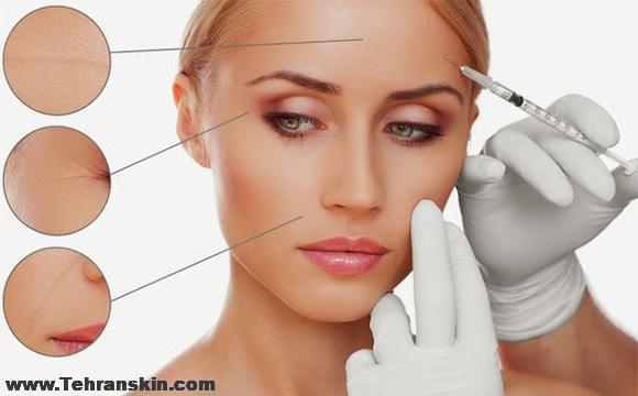 مزوتراپی صورت در اهواز