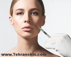 تزریق ژل گونه در اهواز