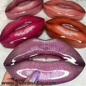 مراقبت های بعد از تزریق ژل لب | بعد از تزریق ژل لب چه باید کرد؟ لب 300x300 - مراقبت های بعد از تزریق ژل لب | بعد از تزریق ژل لب چه باید کرد؟