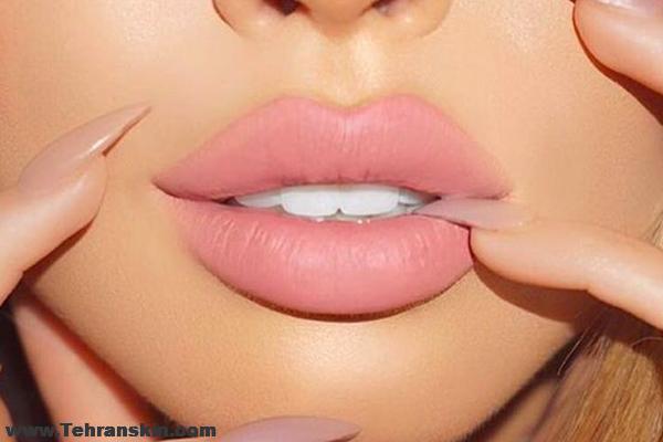 تزریق ژل در لب ها | معرفی بهترین مراکز تزریق ژل لب در اهواز