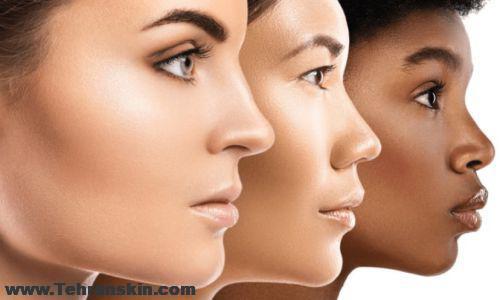 پروتز گونه در تبریز