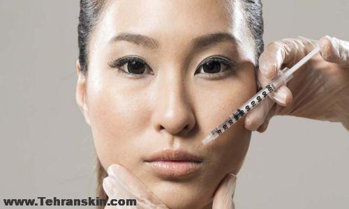 بوتاکس ارزان در کرج