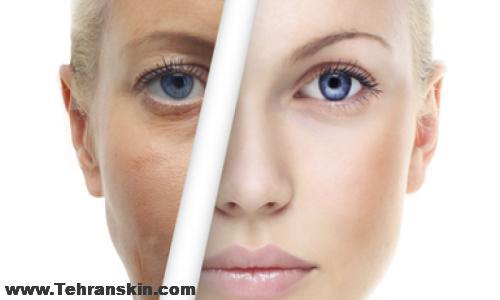 تزریق بوتاکس در زابل