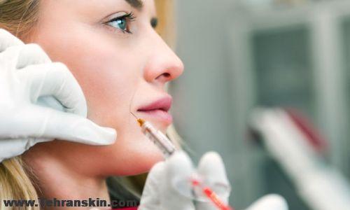 قیمت ژل ژوویدرم