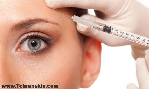 تخفیف بوتاکس در اصفهان